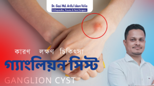 গ্যাংলিয়ন সিস্টের