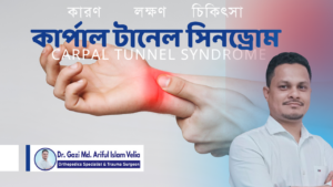 Carpal Tunnel Syndrome