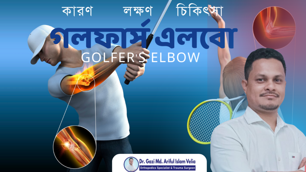 Golfers elbow